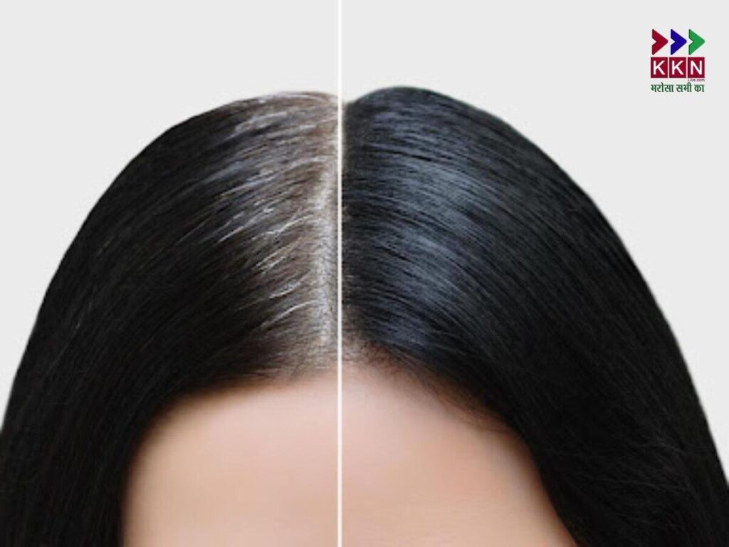 How to Stop Grey Hair Naturally: Effective Ways to Reverse Premature Greying