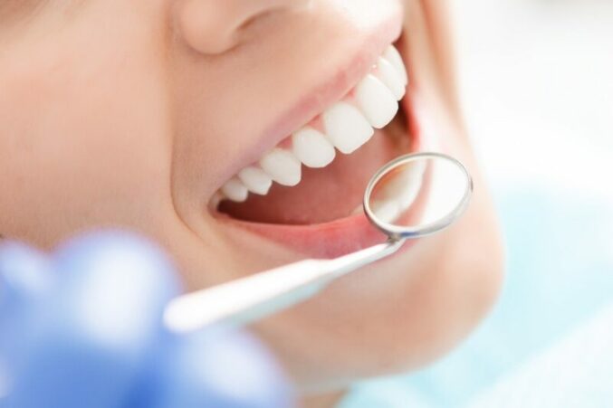 Dental Care Tips : How to Maintain Oral Health and Prevent Tooth Decay, Yellowing, and Bad Breath